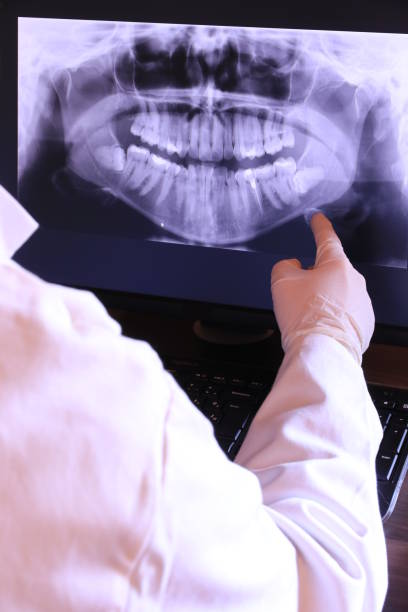 Best Emergency Root Canal Treatment in Hunter, OH