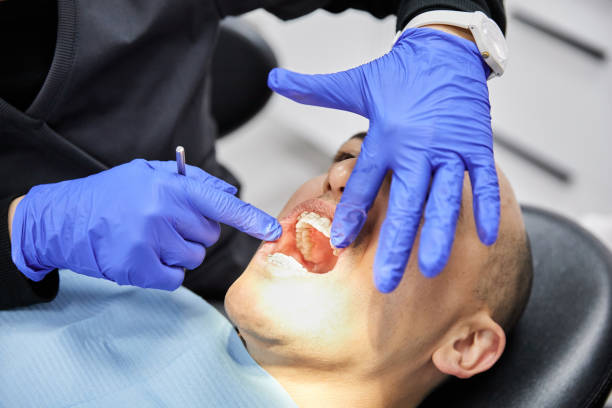 Best Urgent Care for Lost Fillings or Crowns in Hunter, OH
