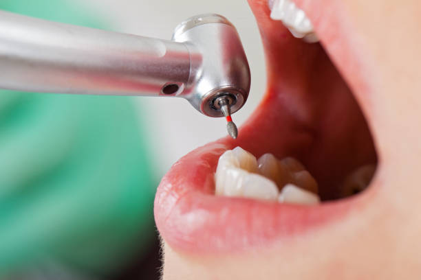Best Pediatric Emergency Dentist in Hunter, OH